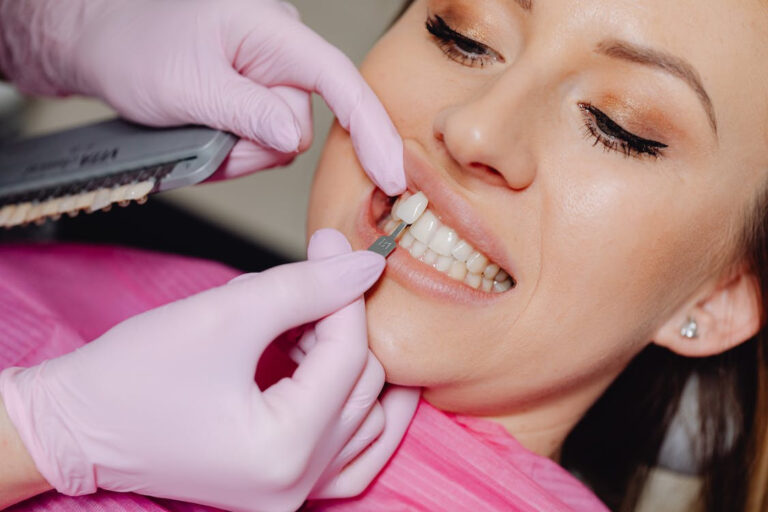 fundas dentales fijas para una mujer