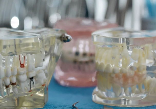 prótesis dental mal adaptada