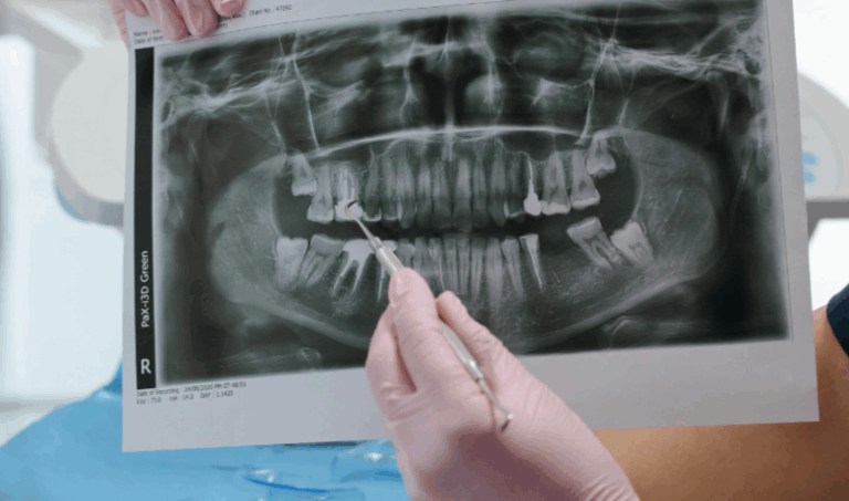 tac dental