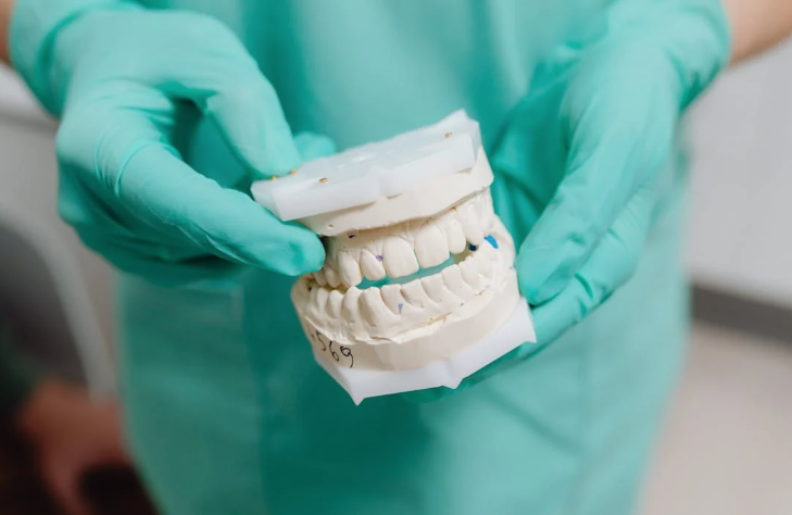 prótesis dental color blanco