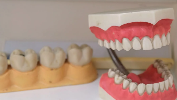 Diseno de sonrisa en Valencia