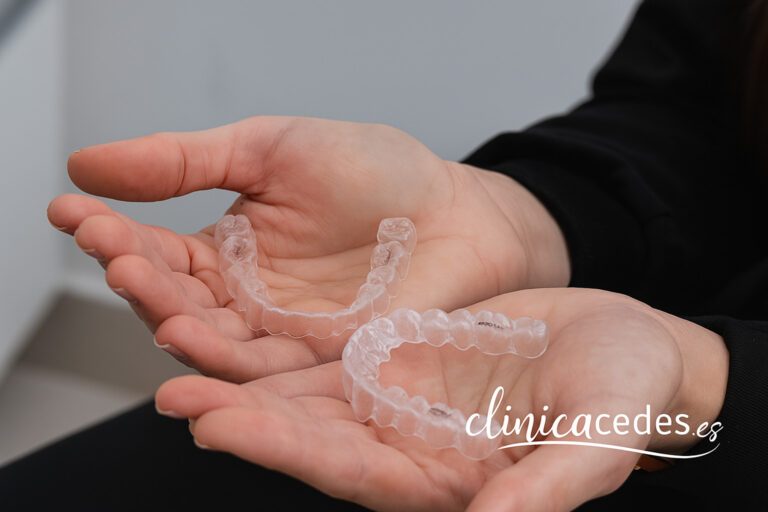 ortodoncia invisible con implantes
