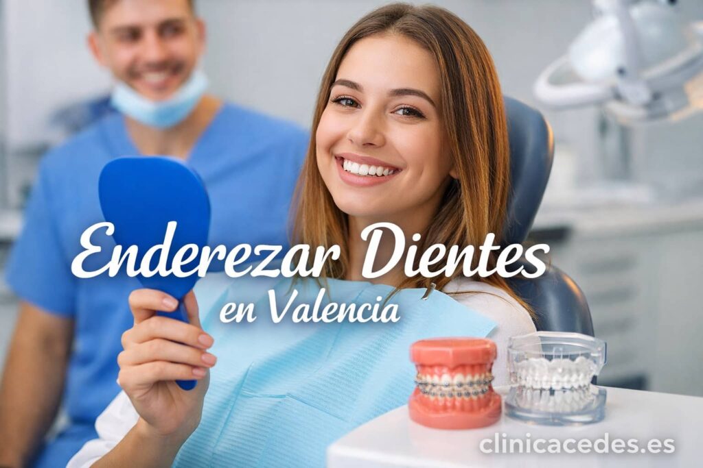 Enderezar dientes en Valencia
