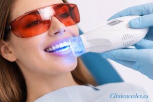 Tratamiento de blanqueamiento dental con luz LED realizado por un dentista para mejorar el color y la estética de los dientes.