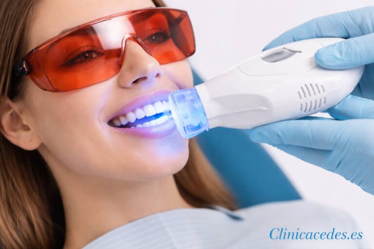 Tratamiento de blanqueamiento dental con luz LED realizado por un dentista para mejorar el color y la estética de los dientes.